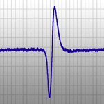 Electrophysiology