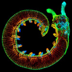 Confocal laser scanning microscopy