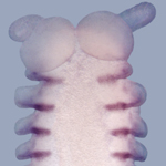 in situ hybridization in situ hybridization